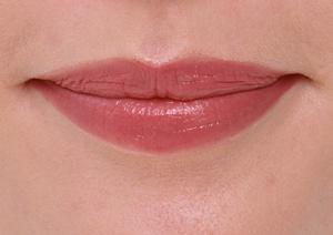 金沢で理想の体型を手に入れよう！痩身施術の選び方とおすすめサロンガイド